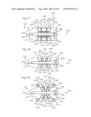 MEDICAL IMPLANTS AND METHODS diagram and image