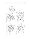 MEDICAL IMPLANTS AND METHODS diagram and image