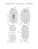 MEDICAL IMPLANTS AND METHODS diagram and image