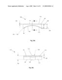 BONE PROSTHESIS diagram and image