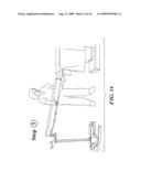 SURGICAL TABLE EXTENSION diagram and image