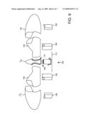 ROTOR HUB MAINTENANCE SYSTEM diagram and image