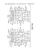 Apparatus and method for removably attaching window treatments diagram and image