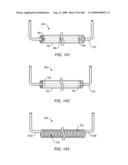 CRYOGENIC TREATMENT OF GAS diagram and image