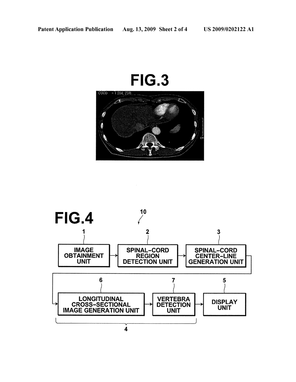 VERTEBRA CENTER DETECTION APPARATUS, METHOD AND RECORDING MEDIUM STORED THEREIN PROGRAM - diagram, schematic, and image 03