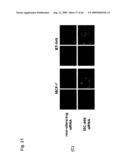 Identification of Tumor-Associated Antigens for Diagnosis and Therapy diagram and image