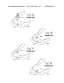 Expandable polymer dental implant and method of use diagram and image