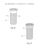 Expandable polymer dental implant and method of use diagram and image