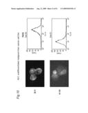 Method of classifying antibody, method of identifying antigen, method of obtaining antibody or antibody set, method of constructing antibody panel and antibody or antibody set and use of the same diagram and image