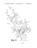 Instruments and methods for minimally invasive tissue retraction and surgery diagram and image