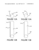 VAGINAL SPECULUM WITH SOLID ROUNDED EDGES diagram and image