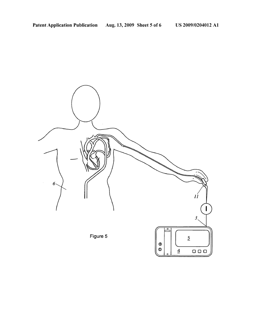 Apparatus and method for determining a physiological parameter - diagram, schematic, and image 06