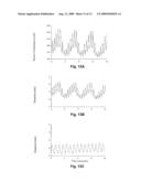 SYSTEMS AND METHODS FOR DETERMINING PHASIC CARDIAC CYCLE MEASUREMENTS diagram and image