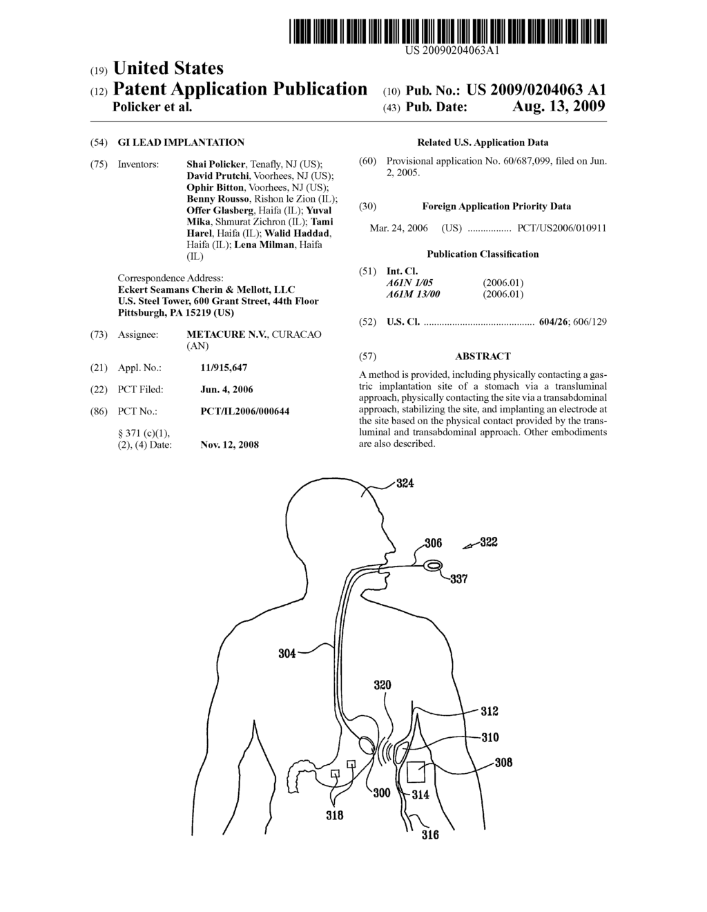 GI Lead Implantation - diagram, schematic, and image 01