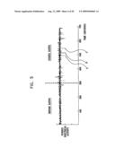 GI Lead Implantation diagram and image