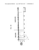 GI Lead Implantation diagram and image