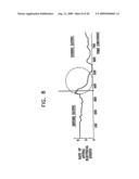 GI Lead Implantation diagram and image