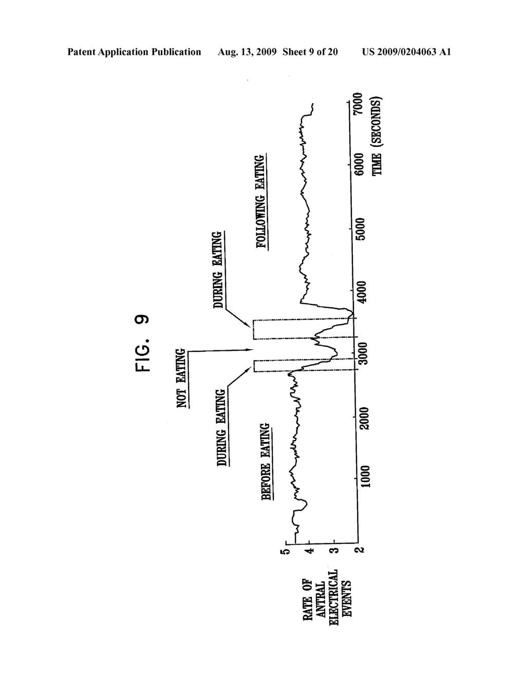 GI Lead Implantation - diagram, schematic, and image 10