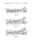 Method and Apparatus for Treating Stenoses at Bifurcated Regions diagram and image