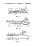 Method and Apparatus for Treating Stenoses at Bifurcated Regions diagram and image