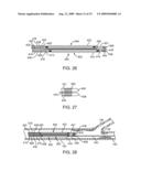 Method and Apparatus for Treating Stenoses at Bifurcated Regions diagram and image