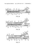 Method and Apparatus for Treating Stenoses at Bifurcated Regions diagram and image