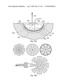 APPARATUS diagram and image