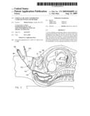 Cervical dilating and ripening catheter system and method diagram and image
