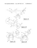 Method for Soft Tissue Attachment diagram and image