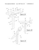 Method for Soft Tissue Attachment diagram and image