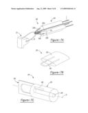 Method for Soft Tissue Attachment diagram and image