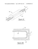 Method for Soft Tissue Attachment diagram and image