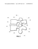 Adjustable Vertebral Body Elevator diagram and image