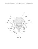 Adjustable Vertebral Body Elevator diagram and image