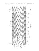 Highly Flexible Stent and Method of Manufacture diagram and image