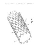 Highly Flexible Stent and Method of Manufacture diagram and image
