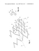 Highly Flexible Stent and Method of Manufacture diagram and image