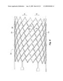 Highly Flexible Stent and Method of Manufacture diagram and image