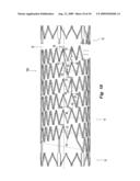 Highly Flexible Stent and Method of Manufacture diagram and image