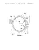 Advanced Electro-Active Optic Device diagram and image