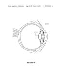 Advanced Electro-Active Optic Device diagram and image