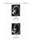 Caspase-9 deficient animals and the use thereof diagram and image