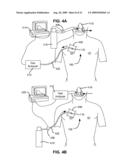 METHODS AND DEVICES FOR FOLLOW-UP CARE AND TREATMENT OF A PNEUMOSTOMA diagram and image