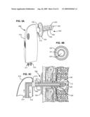 METHODS AND DEVICES FOR FOLLOW-UP CARE AND TREATMENT OF A PNEUMOSTOMA diagram and image