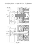 METHODS AND DEVICES FOR FOLLOW-UP CARE AND TREATMENT OF A PNEUMOSTOMA diagram and image