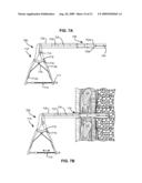 METHODS AND DEVICES FOR FOLLOW-UP CARE AND TREATMENT OF A PNEUMOSTOMA diagram and image