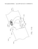 SURGICAL STAPLING APPARATUS WITH ARTICULATABLE COMPONENTS diagram and image