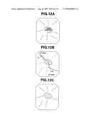 Medical Image Processing Apparatus, Luminal Image Processing Apparatus, Luminal Image Processing Method, and Programs for the Same diagram and image