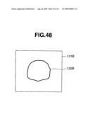 Medical Image Processing Apparatus, Luminal Image Processing Apparatus, Luminal Image Processing Method, and Programs for the Same diagram and image