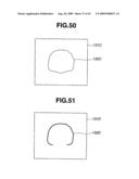 Medical Image Processing Apparatus, Luminal Image Processing Apparatus, Luminal Image Processing Method, and Programs for the Same diagram and image